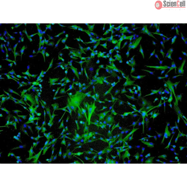 Human Astrocytes-spinal cord (HA-sp) - Immunostaining for GFAP, 100x.
