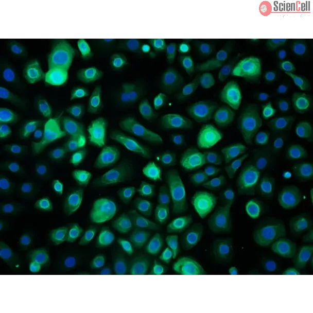 Human Bronchial Epithelial Cells-adult (HBEpiC-a) - Immunostaining for CK-18 200x