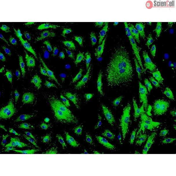 Human Cardiac Microvascular Endothelial Cells (HCMEC) - Immunostaining for vWF, 200x.

