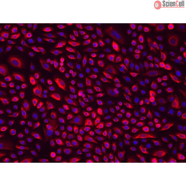 Human Cervical Epithelial Cells (HCerEpiC)-Immunostaining for CK-18, 200x.
