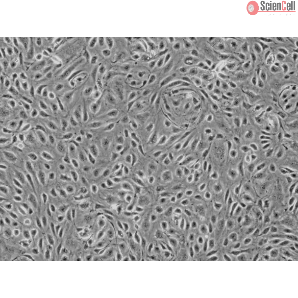 Human Colonic Microvascular Endothelial Cells (HCoMEC) - Phase contrast, 100x.
