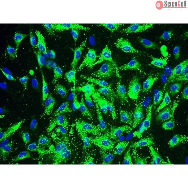 Human Coronary Artery Endothelial Cells (HCAEC) - Immunostaining for vWF, 200x.
