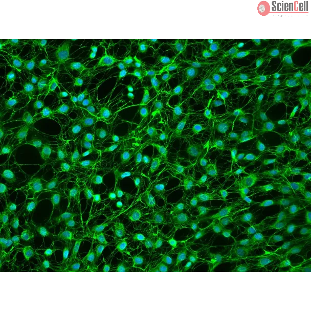 Human Dural Fibroblasts - Immunostaining for FN, 200X
