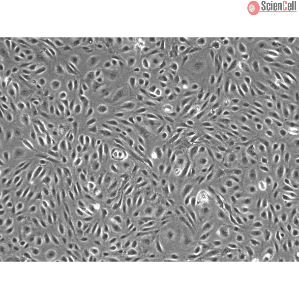 Human Dural Microvascular Endothelial Cells - Phase Contrast, 100X
