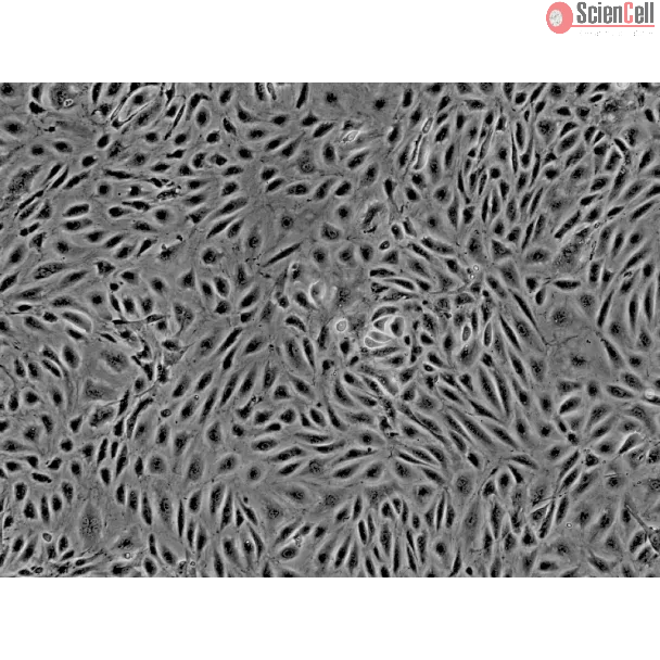 Human Endometrial Microvascular Endothelial Cells (HEMEC)-Phase Contrast, 200x.
