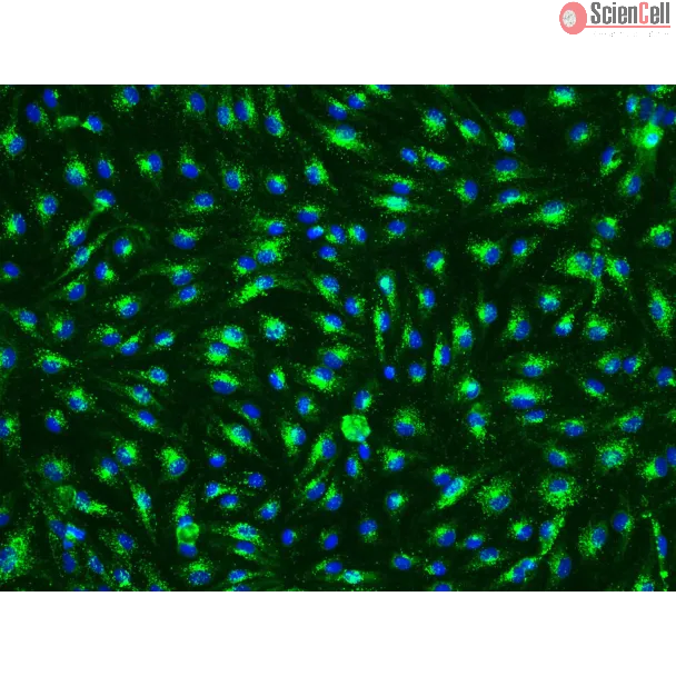 Human Esophageal Endothelial Cells (HEEC) - Immunostaining for vWF, 200x.
