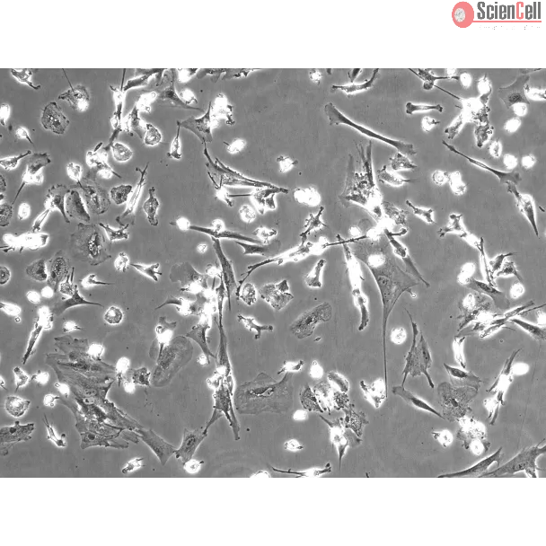 Human Hepatic Macrophages (HHMa) – Phase Contrast, 100x
