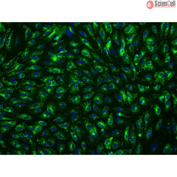 Human Hepatic Sinusoidal Endothelial Cells (HHSEC) - Immunostaining for vWF, 200x

