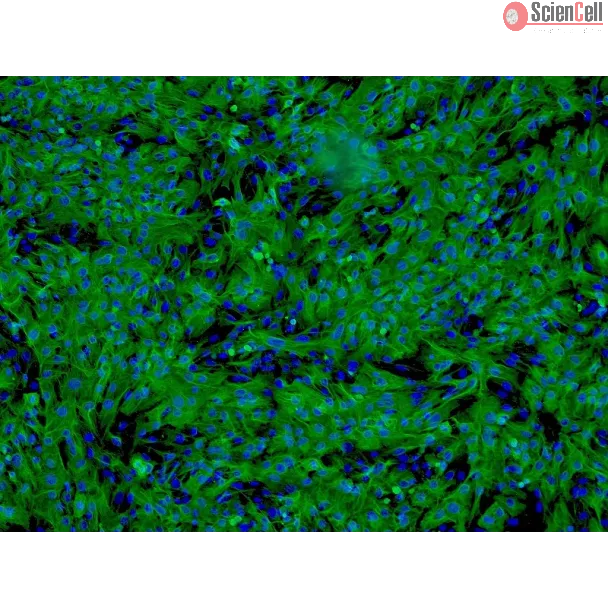 Human Hepatocytes (HH) - Immunostaining for CK-18, 100x.
