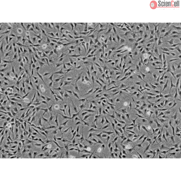 Human Keratocytes (HK) - Phase contrast, 100x.
