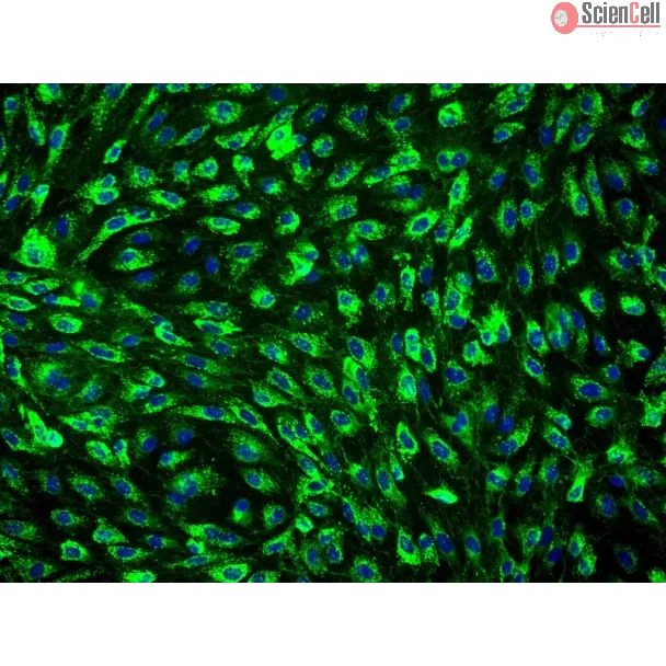 Human Mammary Microvascular Endothelial Cells (HMMEC) - Immunostaining for vWF, 200x.
