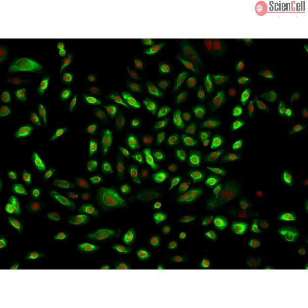 Human Middle Ear Epithelial Cells (HMEEpiC)-Immunostaining for CK-18, 200x