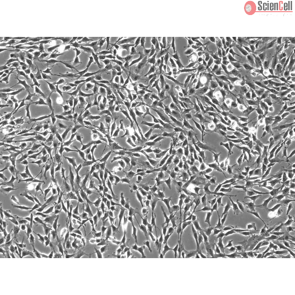 Human Oral Fibroblasts (HOrF) – Phase Contrast, 100x
