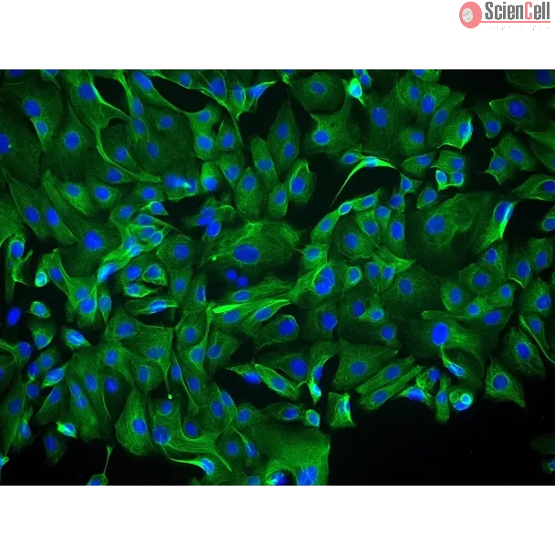 Human Ovarian Surface Epithelial Cells (HOSEpiC) - Immunostaining for CK-18, 400x.
