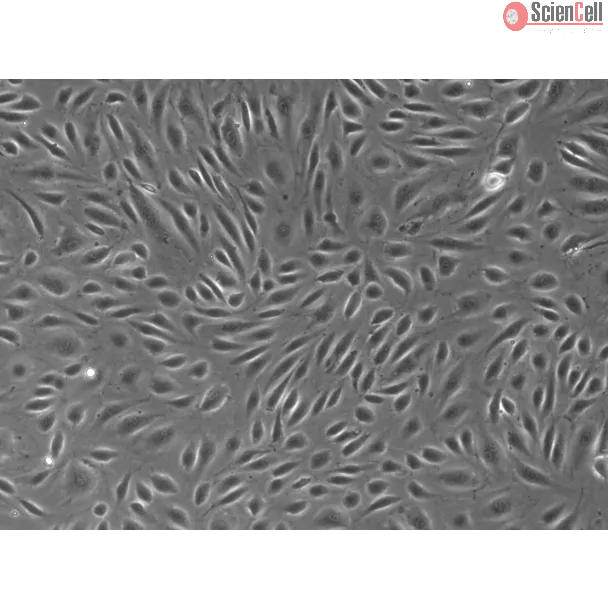 Human Placental Vascular Endothelial Cells (HPVEC) – Phase Contrast, 100x
