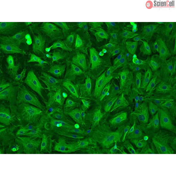 Human Pulmonary Alveolar Epithelial Cells-adult (HPAEpiC-a) - Immunostaining for CK-18 200x