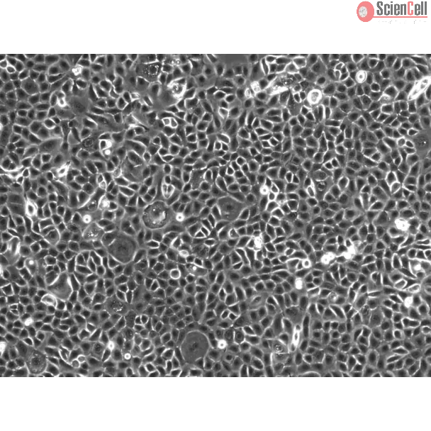 Human Small Airway Epithelial Cells-adult (HSAEpiC-a) - Phase contrast 100x