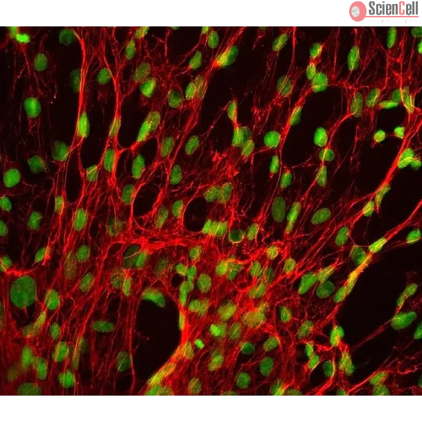 Human Splenic Fibroblasts (HSF) - Immunostaining for Fibronectin, 400x.
