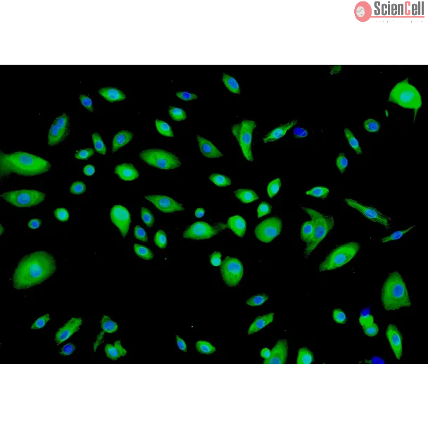 Human Thymic Epithelial Cells (HTyEpiC)-Immunostaining for Cytokeratin-18, 200x.
