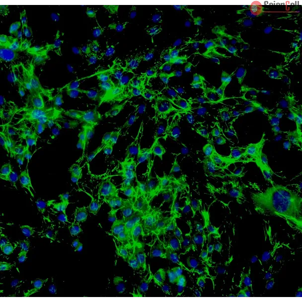 Human Thyroid Fibroblasts (HThF) - Immunostaining for Fibronectin, 200x.
