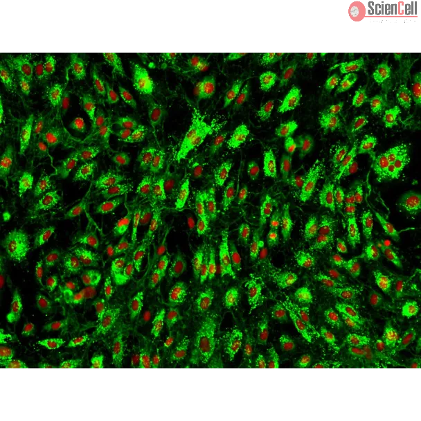 Human Tonsil Endothelial Cells (HTEC) – Immunostaining for vWF, 200x
