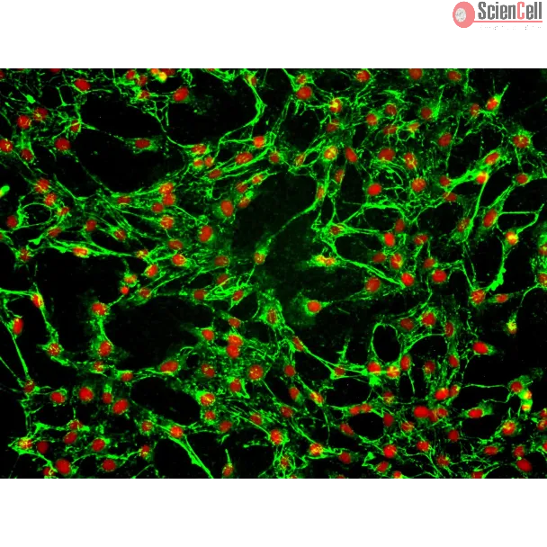 Human Tracheal Fibroblasts (HTrF) – Immunostaining for FN, 200x
