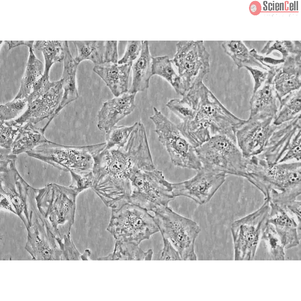 Human Villous Trophoblasts (HVT) - Phase Contrast, 400x
