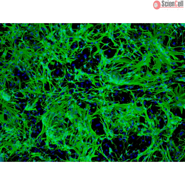 Mouse Astrocytes-midbrain (MA-mb) - Immunostaining for GFAP, 100x.
