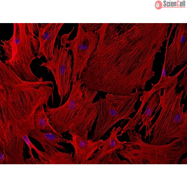 Mouse Brain Vascular Pericytes (MBVP) - Immunostaining for α-sma, 200x
