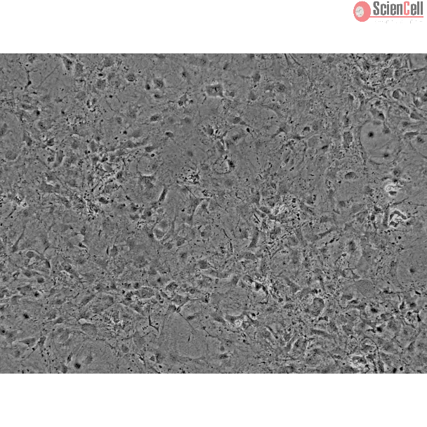 Mouse Cardiac Myocytes (MCF) - Phase contrast, 100x.