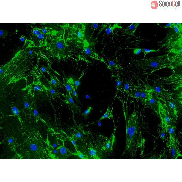 Mouse Cardiac Fibroblasts (MCF) - Immunostaining for Fibronectin, 200x.