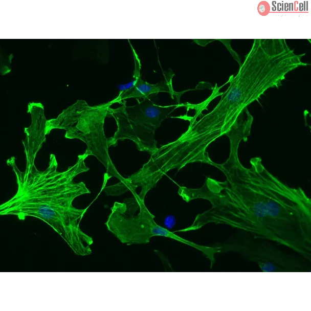 Mouse Hepatic Stellate Cells (MHSteC) – Immunostaining for α-sma, 200x
