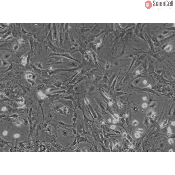 Mouse Hepatic Stellate Cells (MHSteC) - Phase contrast, 100x.
