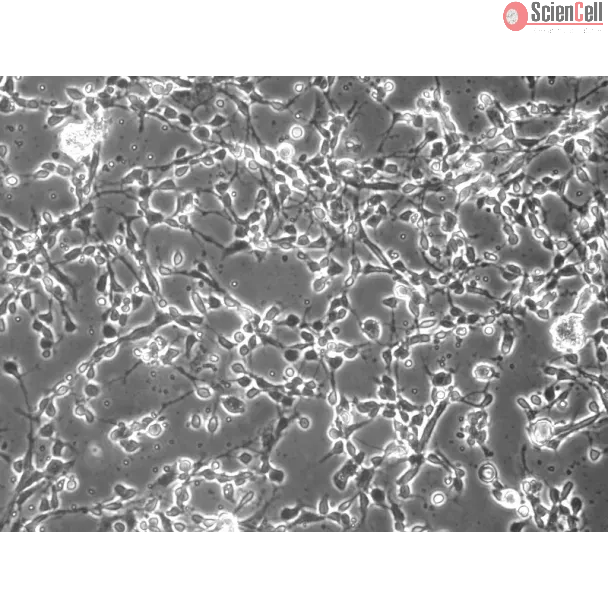 Mouse Neurons-raphe (MN-r) - Phase contrast, 200x.
