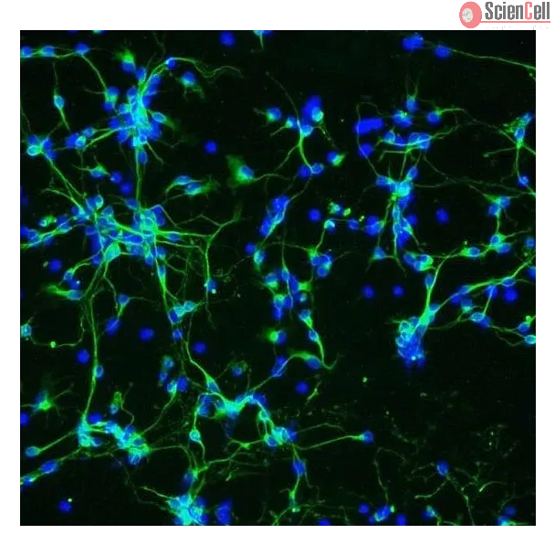 Mouse Neurons-substania nigra (MN-sn) - Immunostaining for β-Tubulin III, 200x.
