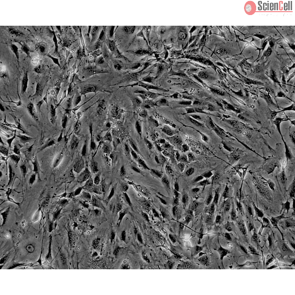 Mouse Perineurial Fibroblasts (MPNF) - Phase contrast, 100x.
