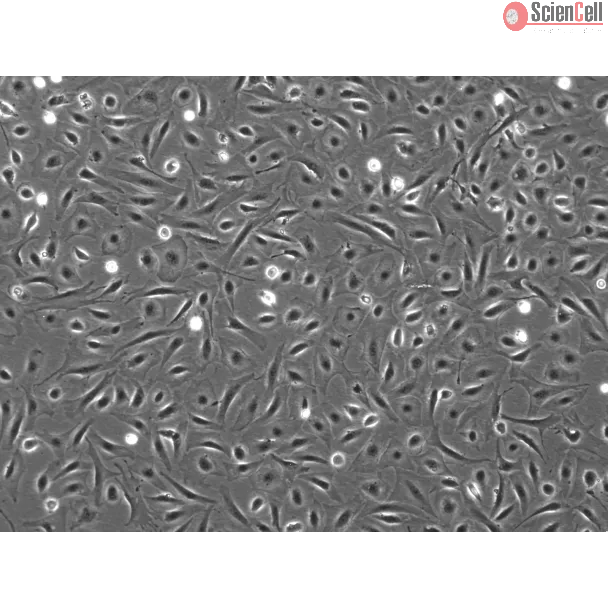 Mouse Pulmonary Alveolar Epithelial Cells (MPAEpiC) - Phase contrast, 100x
