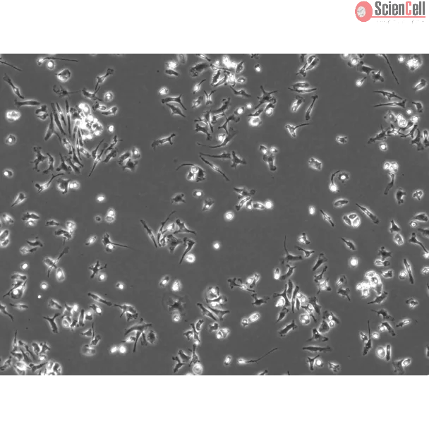 Mouse Pulmonary Alveolar Macrophages (MPAMa) - Phase contrast, 100x

