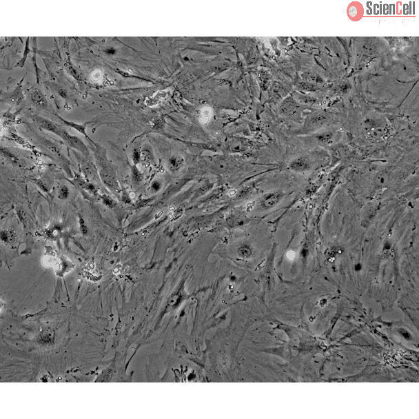 Mouse Renal Mesangial Cells (MRMC) - Phase contrast, 100x.
