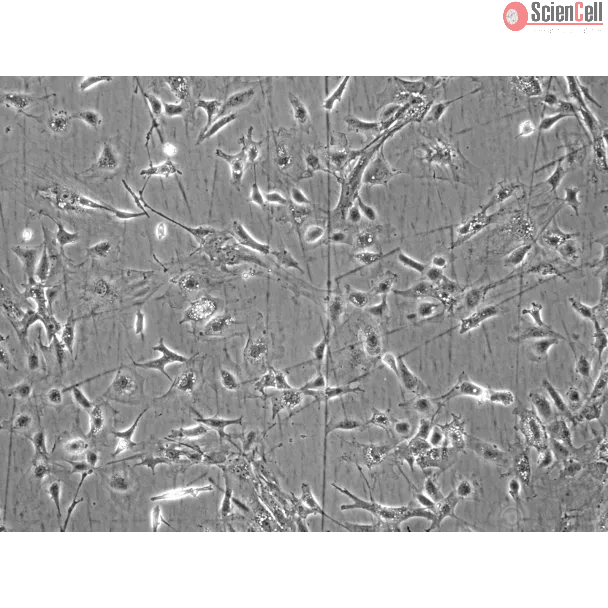 Mouse Renal Mesangial Cells (MRMC) - Phase contrast, 100x.
