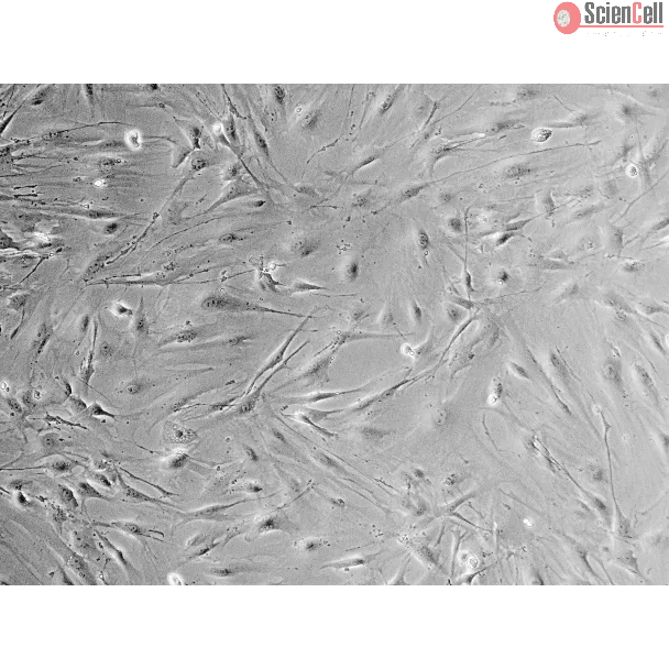 Mouse Salivary Gland Fibroblasts (MSGF) - Phase contrast, 100x.
