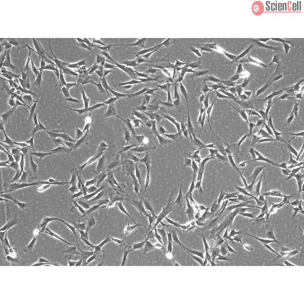 Rabbit Cardiac Fibroblasts (RabCF) – Phase Contrast, 100X.