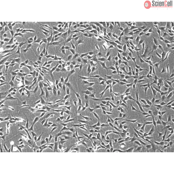 Rabbit Dermal Fibroblasts (RabDF) – Phase Contrast, 100X.

