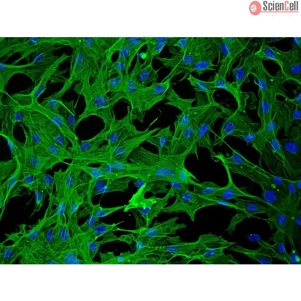 Rabbit Hepatic Stellate Cells (RabHSteC) – Immunostaining for alpha-smooth muscle actin, 200x.
