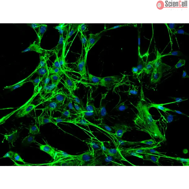 Rabbit Pulmonary Fibroblasts (RabPF) – Immunostaining for FN, 200x.
