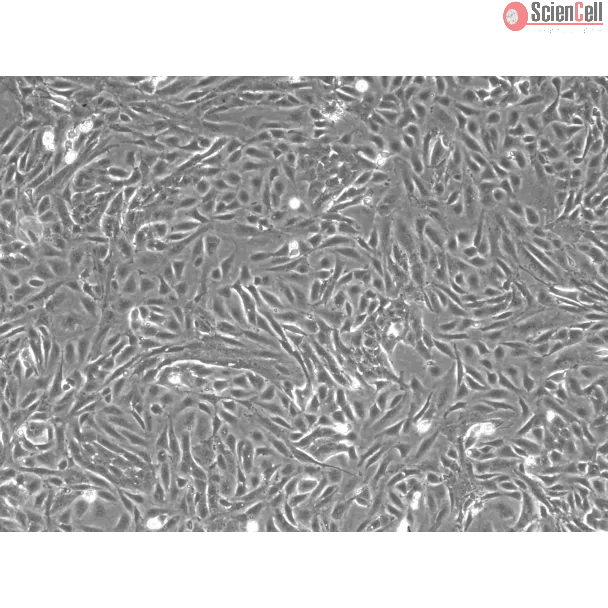 Rabbit Renal Proximal Tubule Epithelial Cells (RabRPTEpiC) – Phase Contrast, 100X.
