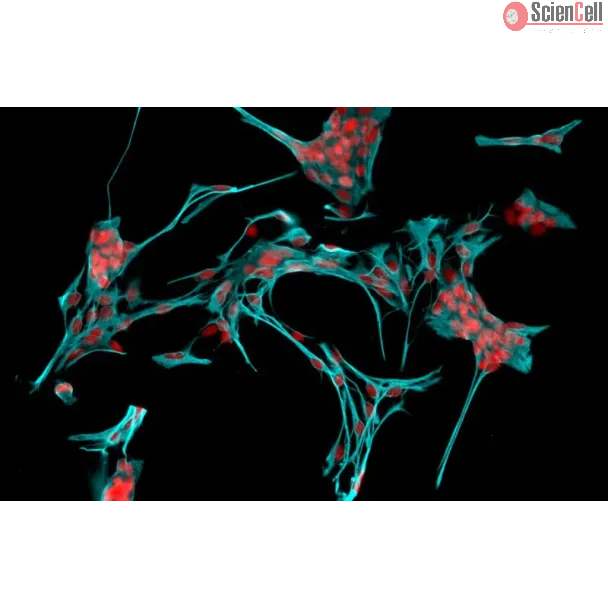 Rat Astrocytes-cerebellar (RA-h) - Immunostaining for GFAP, 200x.
