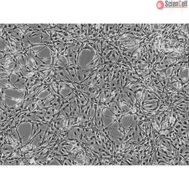 Rat Astrocytes (RA) - Phase contrast, 100x.
