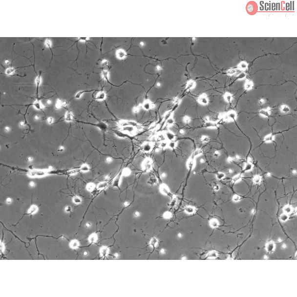 Rat Cerebellar Granule Cells (RGC) - Phase contrast, 200x.
