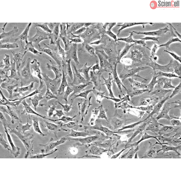 Rat Embryonic Fibroblasts (REF) - Phase contrast, 200x.
